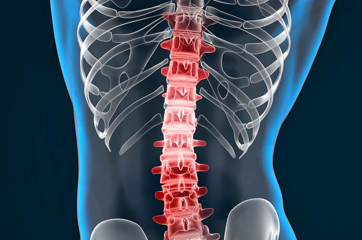 Lumbalgia en el corredor