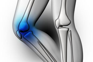 Viscosuplementación 0